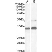 abx431494 (1 µg/ml) staining of Human Kidney (A) and HeLa cell (B) lysate (35 µg protein in RIPA buffer). Detected by chemiluminescence.