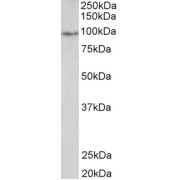 abx431504 (2 µg/ml) staining of Human Uterus lysate (35 µg protein in RIPA buffer). Primary incubation was 1 hour. Detected by chemiluminescence.