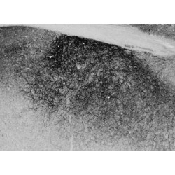 Proenkephalin A (PENK) Antibody