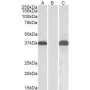 HEK293 lysate (10 µg protein in RIPA buffer) overexpressing Human PIM2 with C-terminal MYC tag probed with abx431508 (0.1 µg/ml) in Lane A and probed with anti-MYC Tag (1/1000) in lane C. Mock-transfected HEK293 probed with abx431508 (0.1mg/ml) in Lane B. Primary incubations were for 1 hour. Detected by chemiluminescence.