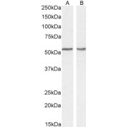 Western blot analysis of extracts of Jurkat nuclear (A) and LNCaP (B) cell lysate (35 µg protein in RIPA buffer) using Septin 4 antibody (0.3 µg/ml).