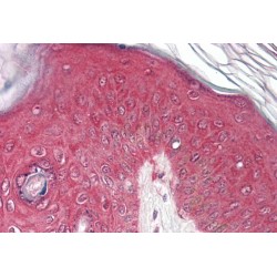 Proteasome Subunit Beta Type 4 (PSMB4) Antibody