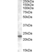 abx431544 (0.2 µg/ml) staining of Mouse Kidney lysate (35 µg protein in RIPA buffer). Primary incubation was 1 hour. Detected by chemiluminescence.