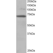 abx431549 staining (0.2 µg/ml) of 3T3 lysate (RIPA buffer, 35 µg total protein per lane). Primary incubated for 1 hour. Detected by chemiluminescence.