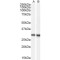 Doublecortin Domain Containing Protein 2 (DCDC2) Antibody