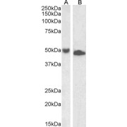 abx431562 (1 µg/ml) staining of Jurkat (A) and K562 (B) lysate (35 µg protein in RIPA buffer). Primary incubation was 1 hour. Detected by chemiluminescence.