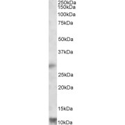 abx431563 (1 µg/ml) staining of Human Heart lysate (35 µg protein in RIPA buffer). Primary incubation was 1 hour. Detected by chemiluminescence.