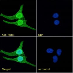 Nuclear Receptor ROR-Gamma (RORC) Antibody