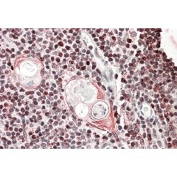 SATB Homeobox 1 (SATB1) Antibody
