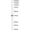 E3 Ubiquitin-Protein Ligase SIAH1 (SIAH1) Antibody
