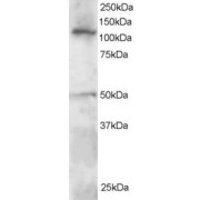 abx431594 staining (0.5 µg/ml) of Jurkat lysate (RIPA buffer, 30 µg total protein per lane). Primary incubated for 1 hour. Detected by western blot using chemiluminescence.