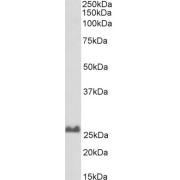 Western blot analysis of Rat Brain lysate (35 µg protein in RIPA buffer) using biotin-conjugated Synaptosomal-Associated Protein 25 (SNAP25) Antibody (0.1 µg/ml, 1 hour). Detected by chemiluminescence, using streptavidin-HRP and using NAP blocker as a substitute for skimmed milk.