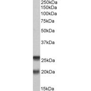 abx431599 (0.2 µg/ml) staining of PBMC lysate (35 µg protein in RIPA buffer). Primary incubation was 1 hour. Detected by chemiluminescence.