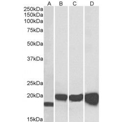 Superoxide Dismutase 1 (SOD1) Antibody