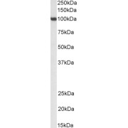 abx431608 (0.3 µg/ml) staining of NIH3T3 nuclear lysate (35 µg protein in RIPA buffer). Primary incubation was 1 hour. Detected by chemiluminescence.