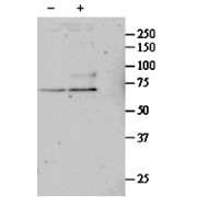 abx431612 (1 µg/ml) staining of untreated (first lane) and TGF-bl-treated (second lane) primary cultured Human Lung fibroblast lysate. Primary incubated overnight at 4C. Detected by western blot using chemiluminescence. Data kindly provided by Nickolai Dulin, Dept Medicine/Pulmonary, Chicago, USA.