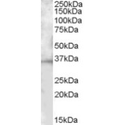 abx431613