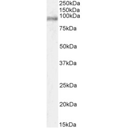 Signal Transducer And Activator of Transcription 3 (STAT3) Antibody