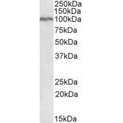 abx431618 (0.1 µg/ml) staining of K562 lysate (35 µg protein in RIPA buffer). Primary incubation was 1 hour. Detected by chemiluminescence.