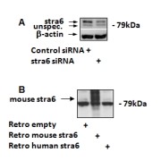 abx431622 (1.7 µg/ml) staining of 3T3-L1 lysates (35 µg protein in RIPA buffer). Detected by chemiluminescence.