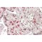 Transcription Factor-Like Protein 4 (MLX) Antibody