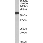 abx431648 (1 µg/ml) staining of Human Liver lysate (35 µg protein in RIPA buffer). Primary incubation was 1 hour. Detected by chemiluminescence.