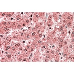 Aldehyde Dehydrogenase 5 Family Member A1 (ALDH5A1) Antibody