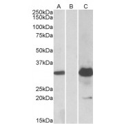 HEK293 lysate (10 µg protein in RIPA buffer) overexpressing Human KCTD11 with DYKDDDDK tag probed with abx431661 (1.0 µg/ml) in Lane A and probed with anti-DYKDDDDK Tag (1/5000) in lane C. Mock-transfected HEK293 probed with abx431661 (1mg/ml) in Lane B. Primary incubations were for 1 hour. Detected by chemiluminescence.