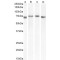 Transforming Growth Factor Beta Induced Protein (TGFBI) Antibody