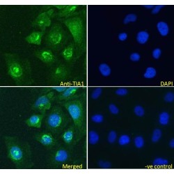 Nucleolysin TIA-1 Isoform P40 (TIA1) Antibody