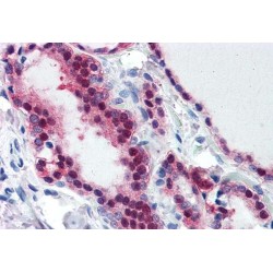 Nucleolysin TIA-1 Isoform P40 (TIA1) Antibody