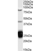 abx431671 (0.1 µg/ml) staining of Jurkat cell lysate (35 µg protein in RIPA buffer). Detected by chemiluminescence.