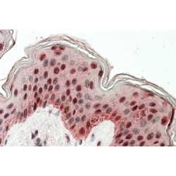 TIAL1 & TIA Antibody