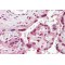 Spindle And Kinetochore Associated Complex Subunit 3 (SKA3) Antibody