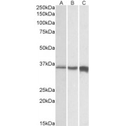 abx431679 (0.01 µg/ml) staining of Human (A), Mouse (B) and Rat (C) Skeletal Muscle lysates (35 µg protein in RIPA buffer). Primary incubation was 1 hour. Detected by chemiluminescence.