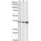 Troponin T, Fast Skeletal Muscle (TNNT3) (TNNT3) Antibody