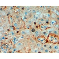 Triosephosphate isomerase Antibody