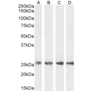 Western blot analysis of extracts of HepG2 (A), HEK293 (B), HeLa (C) and Jurkat (D) cell lysate (30 µg protein RIPA buffer) using TPI1 antibody (0.001 µg/ml).