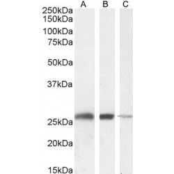 Triosephosphate isomerase Antibody