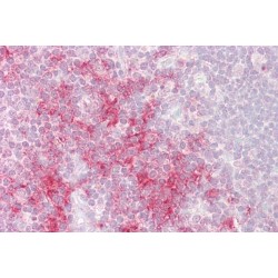 TNF Receptor-Associated Factor 1 (TRAF1) Antibody