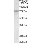 abx431686 (0.3 µg/ml) staining of A431 lysate (35 µg protein in RIPA buffer). Primary incubation was 1 hour. Detected by chemiluminescence.