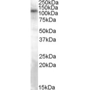 abx431687 (0.3 µg/ml) staining of Rat Brain lysate (35 µg protein in RIPA buffer). Detected by chemiluminescence.