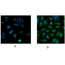 Ubiquitin-Conjugating Enzyme E2 L3 (UBE2L3) Antibody