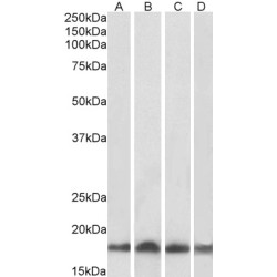 Ubiquitin-Conjugating Enzyme E2 L3 (UBE2L3) Antibody