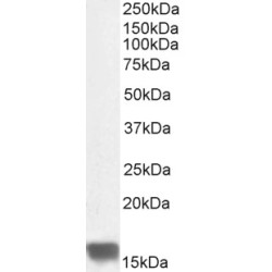 SUMO-Conjugating Enzyme UBC9 (UBE2I) Antibody