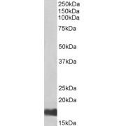 Western blot analysis of Human Kidney lysate (35 µg protein in RIPA buffer), using biotin-conjugated SUMO-Conjugating Enzyme UBC9 (UBE2I) Antibody (0.5 µg/ml). Detected by chemiluminescence, using streptavidin-HRP and using NAP blocker as a substitute for skimmed milk.