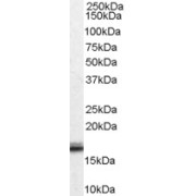 abx431703 (0.01 µg/ml) staining of Human Ovary lysate (35 µg protein in RIPA buffer). Detected by chemiluminescence.