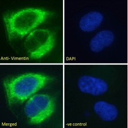 Vimentin (VIM) Antibody