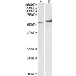 Vimentin (VIM) Antibody