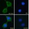 Transient Receptor Potential Cation Channel Subfamily V Member 2 (Trpv2) Antibody